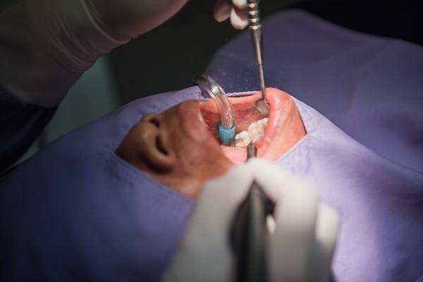 Can A Deep Dental Cleaning Treat Gum Disease?
