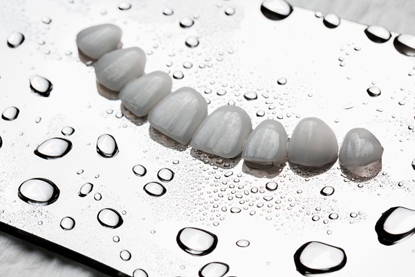How To Care For Your Dental Veneers